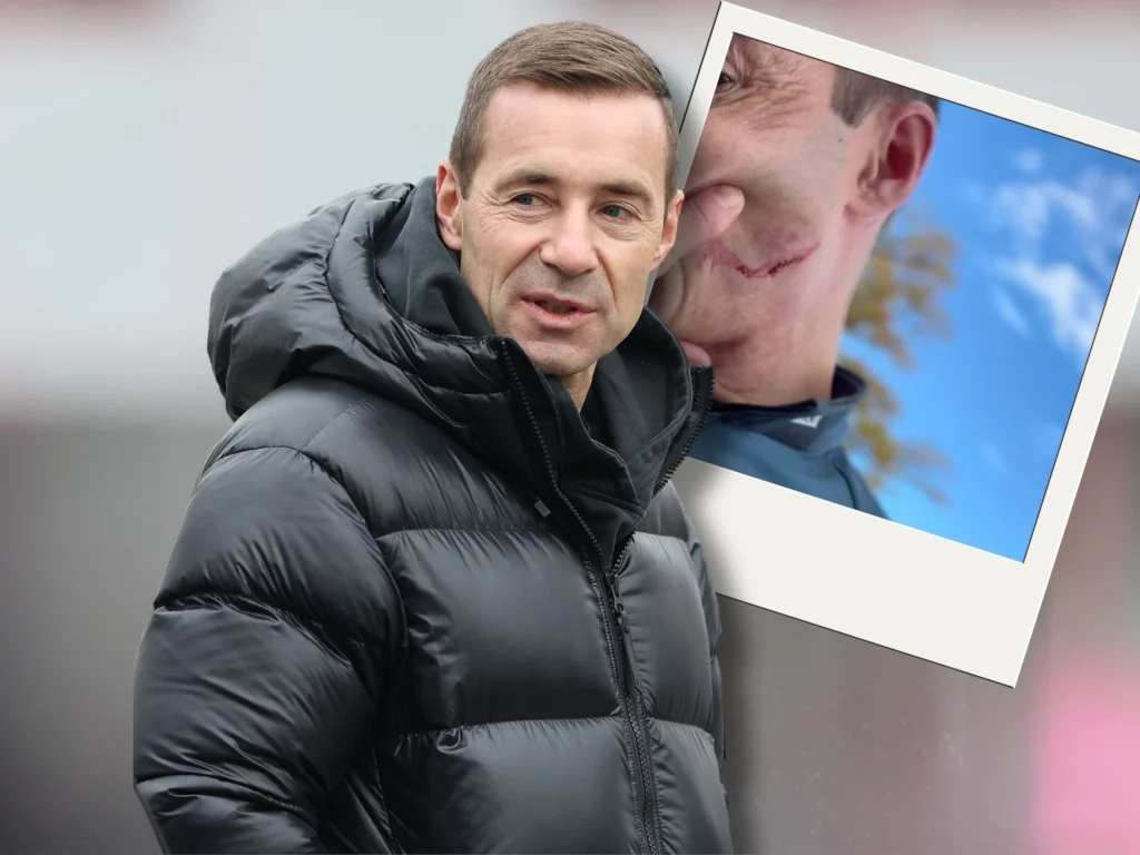 kai pflaume schlaganfall